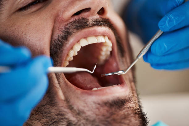 Best Root Canal Emergency Dentist  in South Uniontown, PA